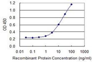 Detection limit for recombinant GST tagged TSC22D3 is 0.