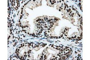 Immunohistochemical staining of paraffin-embedded lung tissue using anti-ARNTL mouse monoclonal antibody.