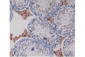 IHC-P analysis of Mouse Testis Tissue, with DAB staining. (PZP anticorps  (AA 1224-1495))