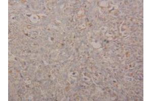 Detection of Arg2 in Human Ovary Tissue using Polyclonal Antibody to Arginase II (Arg2)