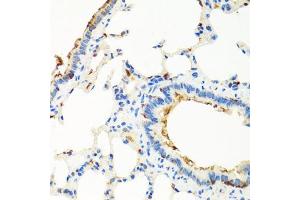 Immunohistochemistry of paraffin-embedded rat lung using RGS5 antibody (ABIN5975077) at dilution of 1/100 (40x lens).