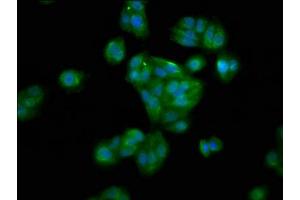 Immunofluorescence staining of HepG2 cells with ABIN7155981 at 1:100, counter-stained with DAPI. (HAO1 anticorps  (AA 161-273))