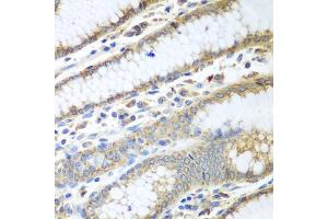 Immunohistochemistry of paraffin-embedded human stomach using PDIA3 antibody (ABIN5970443) at dilution of 1/100 (40x lens). (PDIA3 anticorps)