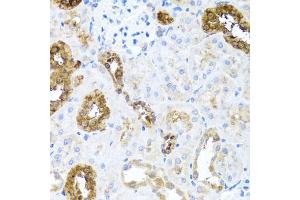 Immunohistochemistry of paraffin-embedded rat kidney using SHH antibody (ABIN5975790) at dilution of 1/100 (40x lens). (Sonic Hedgehog anticorps)