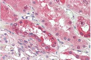 anti-Phosphodiesterase 1A (PDE1A) (C-Term) antibody