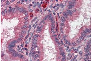 Human Uterus: Formalin-Fixed, Paraffin-Embedded (FFPE)