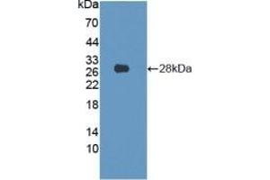 Detection of Recombinant LMNB1, Human using Polyclonal Antibody to Lamin B1 (LMNB1)
