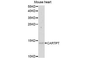 Western blot analysis of extracts of mouse heart, using CARTPT antibody (ABIN5975373) at 1/1000 dilution. (CARTPT anticorps)