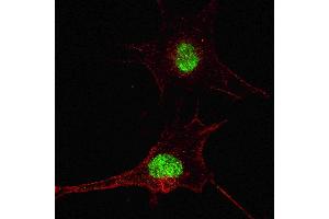 Fluorescent confocal image of SY5Y cells stained with SOX2  antibody. (SOX2 anticorps  (AA 251-284))