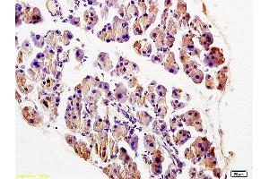 Formalin-fixed and paraffin embedded rat pancreas labeled with Anti-TRADD Polyclonal Antibody, Unconjugated (ABIN673314) at 1:200 followed by conjugation to the secondary antibody and DAB staining. (TRADD anticorps  (AA 111-230))
