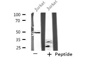 Western blot analysis of extracts from Jurkat cells, using SEPT6 antibody. (Septin 6 anticorps  (Internal Region))
