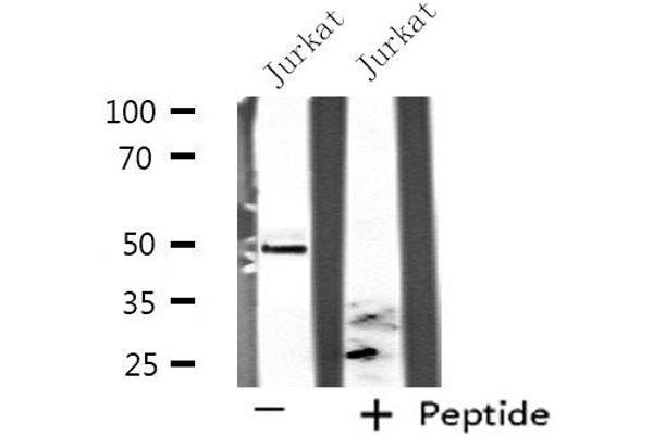 Septin 6 anticorps  (Internal Region)