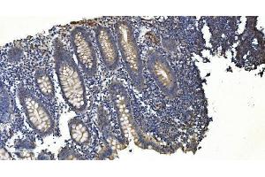 IHC analysis of APPL/APPL1 using anti-APPL/APPL1 antibody (ABIN7602659).