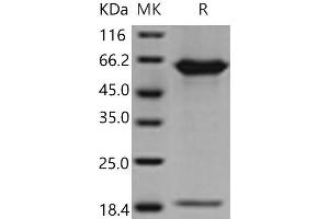Western Blotting (WB) image for Proprotein Convertase Subtilisin/kexin Type 9 (PCSK9) (Active) protein (His tag) (ABIN7321244)