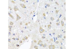 Immunohistochemistry of paraffin-embedded Rat brain using EIF3M Polyclonal Antibody at dilution of 1:100 (40x lens). (Eukaryotic Translation Initiation Factor 3, Subunit M (EIF3M) anticorps)