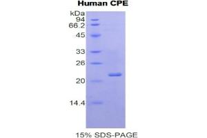 SDS-PAGE of Protein Standard from the Kit  (Highly purified E.
