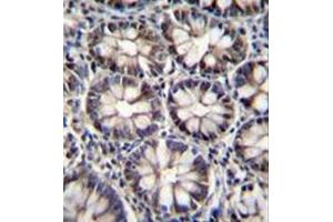 Formalin fixed, paraffin embedded human rectum tissue stained with CTBP2 Antibody (N-term) followed by peroxidase conjugation of the secondary antibody and DAB staining.