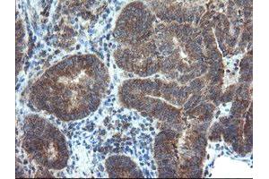 Image no. 1 for anti-Dual Specificity Phosphatase and Pro Isomerase Domain Containing 1 (DUPD1) antibody (ABIN1497927)