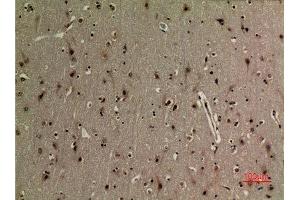 Immunohistochemistry (IHC) analysis of paraffin-embedded Human Brain, antibody was diluted at 1:100.