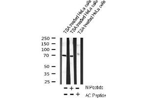 Western blot analysis on TSA treated HeLa cells lysate using AC-FKHR(K294) Antibody (AC-FKHR anticorps)