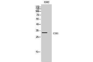 Western Blotting (WB) image for anti-Calcium and Integrin Binding Protein 3 (CIB3) (C-Term) antibody (ABIN3183921) (CIB3 anticorps  (C-Term))