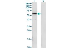 Western Blot analysis of FGFR1OP expression in transfected 293T cell line by FGFR1OP monoclonal antibody (M02), clone 1E8. (FGFR1OP anticorps  (AA 1-379))