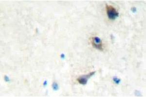 Immunohistochemistry (IHC) analyzes of IMK-1 antibody in paraffin-embedded human brain tissue. (LIM Domain Kinase 1 anticorps)