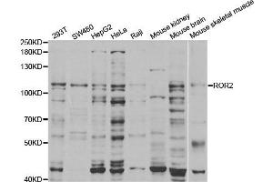 Western Blotting (WB) image for anti-Receptor Tyrosine Kinase-Like Orphan Receptor 2 (ROR2) antibody (ABIN1876821) (ROR2 anticorps)
