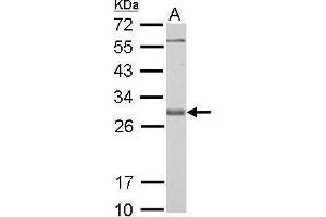 WB Image Bcl-X antibody detects BCL2L1 protein by Western blot analysis.