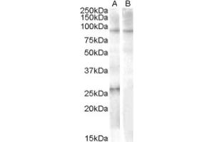 Image no. 1 for anti-Apolipoprotein B mRNA Editing Enzyme, Catalytic Polypeptide-Like 2 (APOBEC2) (Internal Region), (N-Term) antibody (ABIN374923)