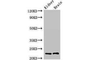 Western Blot Positive WB detected in: Rat kidney tissue, Mouse brain tissue All lanes: CHP1 antibody at 2. (CHP anticorps  (AA 2-195))