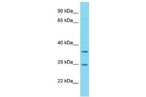 Host: Rabbit Target Name: FAHD1 Sample Type: Hela Whole cell lysates Antibody Dilution: 1. (FAHD1 anticorps  (Middle Region))