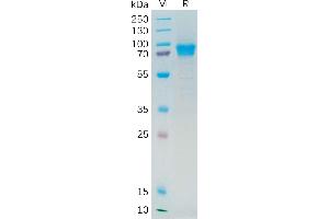 Human IL21R Protein, hFc Tag on SDS-PAGE under reducing condition.