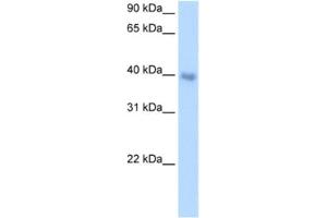 Western Blotting (WB) image for anti-Distal-Less Homeobox 5 (DLX5) antibody (ABIN2460595) (DLX5 anticorps)