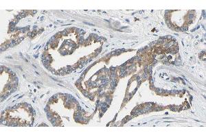 ABIN6277640 at 1/100 staining Human prostate tissue by IHC-P. (Asparagine Synthetase anticorps  (N-Term))