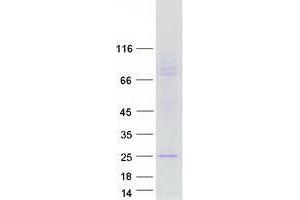 Validation with Western Blot