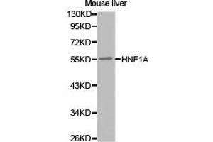 Western Blotting (WB) image for anti-HNF1 Homeobox A (HNF1A) antibody (ABIN1873058) (HNF1A anticorps)