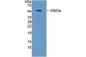 Detection of Recombinant FMOD, Rat using Polyclonal Antibody to Fibromodulin (FMOD)