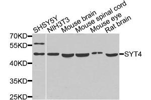 Western blot analysis of extracts of various cells, using SYT4 antibody. (SYT4 anticorps)