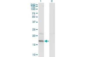 Western Blot analysis of HDDC3 expression in transfected 293T cell line by HDDC3 monoclonal antibody (M05), clone 7E6. (HDDC3 anticorps  (AA 1-140))
