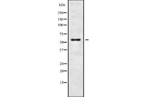 Western blot analysis of KCNG4 using Jurkat whole cell lysates (KCNG4 anticorps  (Internal Region))