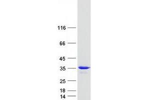 Validation with Western Blot