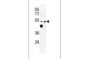 Western blot analysis of LD2 Antibody (C-term) (ABIN653167 and ABIN2842732) in WiDr, MDA-M cell line lysates (35 μg/lane). (Tricellulin anticorps  (C-Term))