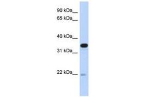 Image no. 1 for anti-Phosphotidylinositol Transfer Protein, beta (PITPNB) (AA 107-156) antibody (ABIN6743263) (PITPNB anticorps  (AA 107-156))