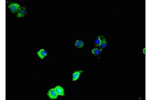 Immunofluorescent analysis of Hela cells using ABIN7160057 at dilution of 1:100 and Alexa Fluor 488-congugated AffiniPure Goat Anti-Rabbit IgG(H+L) (MAP3K8 anticorps  (AA 1-300))