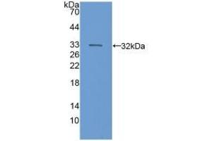 Detection of Recombinant C6, Human using Polyclonal Antibody to Complement Component 6 (C6) (C6 anticorps  (AA 682-934))