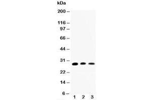 Western blot testing of AQP1 antibody and Lane 1:  rat kidney;  2: rat lung;  3: SMMC-7721 cell lysate (Aquaporin 1 anticorps  (C-Term))