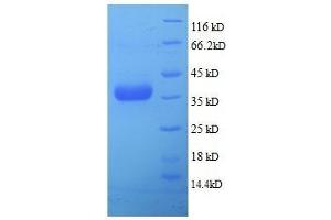SDS-PAGE (SDS) image for Serine Peptidase Inhibitor, Kazal Type 7 (SPINK7) (full length) protein (ABIN7479575)