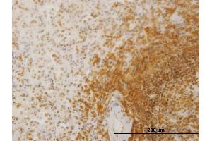 Immunoperoxidase of monoclonal antibody to SLC26A3 on formalin-fixed paraffin-embedded human spleen.