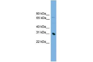 Human Jurkat; WB Suggested Anti-PRSS8 Antibody Titration: 0. (PRSS8 anticorps  (Middle Region))
